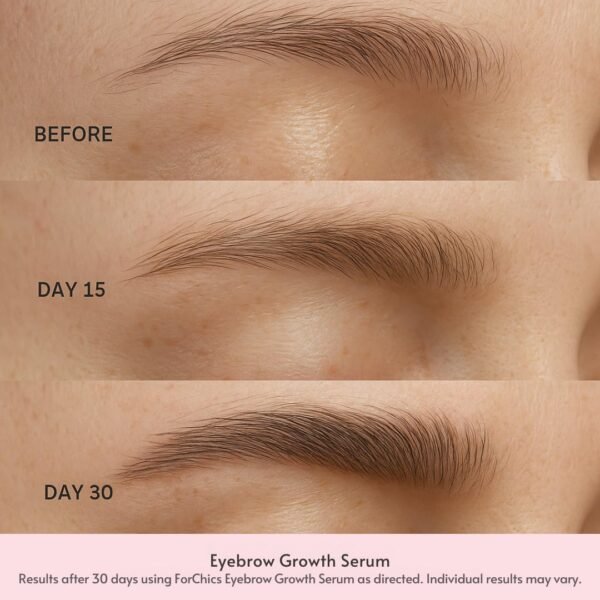 61YZuEyjkTL._AC_SL1080_ ForChics ForBrow Eyebrow Growth Serum – For Thicker, Fuller Brows