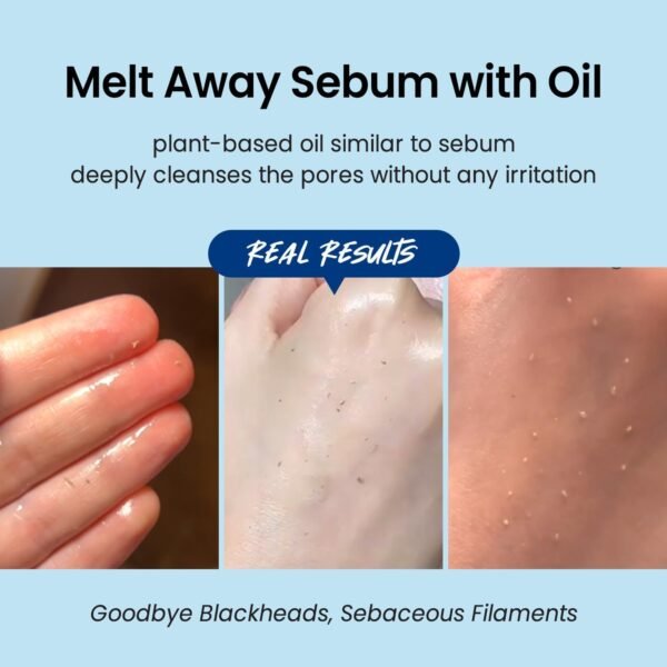 COXIR Ultra-Hyaluronic Cleansing Oil — Deep Clean & Hydrate Makeup Remover with Cactus, Rosehip & Camellia Oil, 150 ml / 5.07 fl.oz.