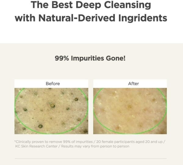 Before and after results of deep pore cleansing